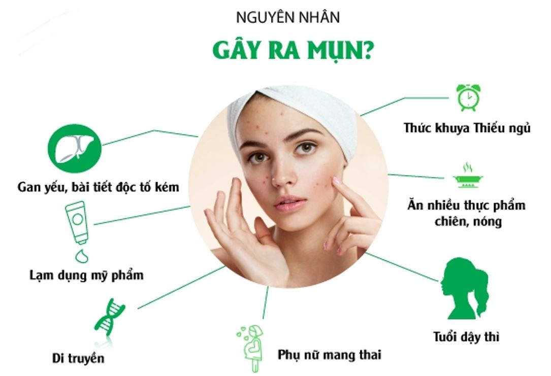 Những nguyên nhân hàng đầu gây ra mụn 2